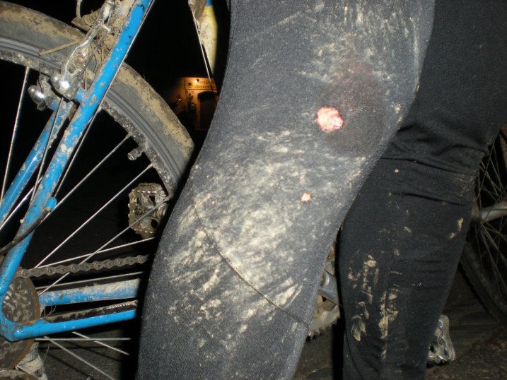 Knie Michael B&uuml;bl